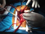 Ngày mới - Sự sống mong manh của bệnh nhi có tim bên phải