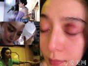 Làng sao - Mỹ nhân Cbiz đau đớn gặp chấn thương trên phim trường