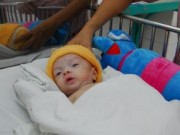 Tin tức - Cháu bé bị cha mẹ bỏ rơi vì không có hậu môn