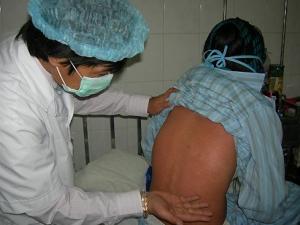Xuất hiện ổ dịch rubella tại Bình Dương: 138 ca nghi nhiễm