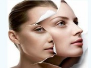 Làm đẹp - Căng bóng da mặt đón tết: Nên hay không?