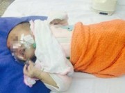 Tin tức - Nhiều trẻ nhỏ nguy kịch vì ho gà