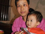 Làm mẹ - Cảm động chuyện người mẹ hy sinh đôi mắt để sinh con