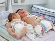 Làm mẹ - Cách tính mức tăng chiều cao cân nặng chuẩn nhất ít mẹ biết