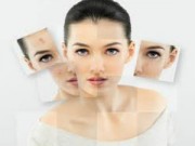 Làm đẹp - Chiêu độc trị mụn nhanh chóng đón Tết