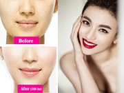 Làm đẹp - Chị em phát 'sốt' với miếng dán tạo mặt V-line không phẫu thuật