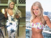 Làm đẹp - Người đẹp quyết tâm phẫu thuật vì bị bạn trai chê ngực lép