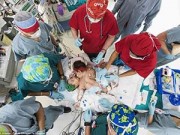 Làm mẹ - Ảnh tuyệt đẹp về ca phẫu thuật tách hai bé dính liền bụng