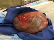 Làm mẹ - Kinh ngạc hình ảnh em bé sinh ra còn nguyên bọc ối