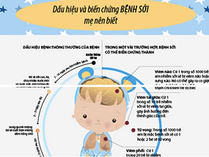 Infographic: Dấu hiệu trẻ bị bệnh sởi và cách điều trị