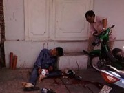 Tin tức - Chán đời, một thanh niên tự cắt cổ giữa phố