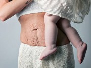 Bà bầu - Tranh cãi quanh những bức ảnh về cơ thể mẹ sau sinh
