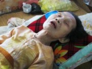 Tin tức - Những người chết đi sống lại hy hữu ở Việt Nam