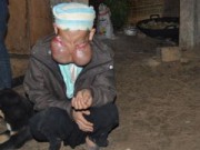 Tin tức - Người đàn bà mang 'gương mặt quỷ' ở Bản Pát