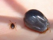 Sức khỏe - Cẩn thận loài bọ chét "đào hang" trên da người