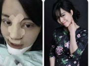 Eva tám - 9X phẫu thuật thẩm mỹ toàn mặt vì sợ chồng 'chán'