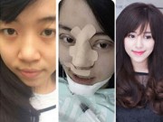 Làm đẹp - Gặp cô gái phẫu thuật toàn mặt vì sợ chồng chán