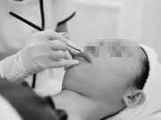 Sức khỏe - Phun xăm môi: Chưa đổi mệnh đã gặp họa