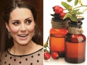 Bà bầu - Tiết lộ ‘chiêu’ giữ da tươi trẻ của bà bầu Kate Middleton