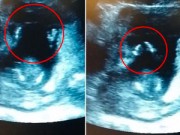 Bà bầu - Kỳ diệu: Thai nhi 14 tuần tuổi vỗ tay khi nghe mẹ hát