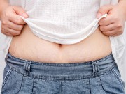 Bà bầu - 7 cách xóa mờ rạn da sau sinh không tốn tiền