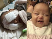 Tin tức - Xót thương bé gái 8 tháng tuổi bị hỏng hai mắt vì ung thư