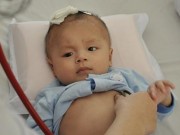 Em bé bị dao đâm vào đầu xuất viện sau lần mổ thứ ba