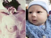 Bà bầu - Nhật ký chi tiết một ca sinh mổ của mẹ trẻ 9x