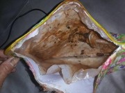 Tin tức - Dùng túi sưởi giữ ấm cơ thể: Coi chừng mất mạng