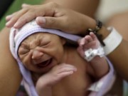 Tin tức - Ám ảnh gương mặt những đứa trẻ bị teo não bởi virus Zika