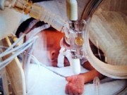 Tin tức - Đứa bé 'chết đi sống lại' sau 15 tiếng trong phòng lạnh âm 12 độ