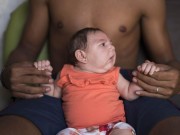 Tin tức - Phụ nữ mang thai làm gì để không bị lây nhiễm virus Zika?