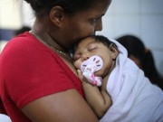 Tin tức - Brazil phát hiện virus Zika trong não của trẻ dị tật đầu nhỏ
