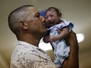 Tin tức - Ngành sản khoa cần vào cuộc để phát hiện sớm trẻ 'teo não'