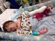 Làm mẹ - Xót xa bé gái xinh đẹp có làn da cánh bướm bởi bệnh lạ