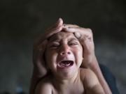 Tin tức - Nghiên cứu vắc xin phòng virus Zika đạt bước tiến mới