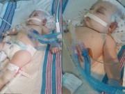 Làm mẹ - Bé sơ sinh trở về từ cõi chết vì bị bố bế rung giờ ra sao?