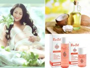Bà bầu - Top 5 loại kem chống rạn da được mẹ bầu Việt ưa thích