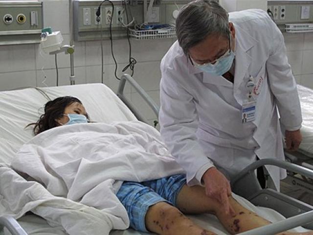 Bệnh viêm não mô cầu xuất hiện ở nhiều tỉnh