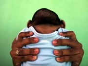 Tin tức - Virus Zika có khả năng gây tử vong thai nhi