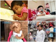 Nuôi con - Xót xa những đứa trẻ kẹt trong thân hình 'không bao giờ lớn'