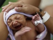 Tin tức - Virus Zika có thể gây rối loạn thần kinh nghiêm trọng