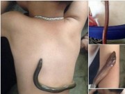 Tin tức - Chuyên gia phản pháo cách dùng lươn hạ sốt cho trẻ