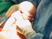 Bà bầu - ‘Sốc nặng’ với những ca đẻ mổ không thấy con trong bụng