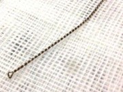 Tin tức - Dụng cụ lấy ráy tai 'mắc kẹt' trong tai một bệnh nhân