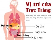 Tin tức - [Infographic] Điều cần biết về bệnh ung thư trực tràng