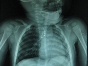 Tin tức - Đừng đánh đổi tính mạng của con vì bất cẩn