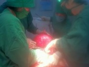 Tin tức - Một phụ nữ bị u xơ tử cung nặng hơn 12 kg