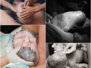 Bà bầu - 10 khoảnh khắc hiếm gặp: Bé sinh ra nằm trong bọc ối