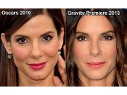 Làm đẹp - Chuyên gia 'tung chiêu' giúp trẻ hóa không cần botox, phẫu thuật